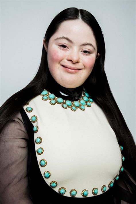 gucci syndrome|gucci models with disability.